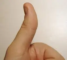 Thumb.webp