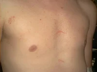 chest.webp