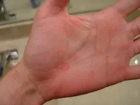 damage1.webp