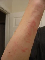 damage2.webp