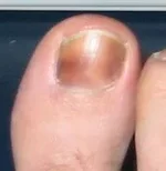 toe2.webp