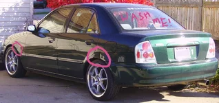 dents.webp