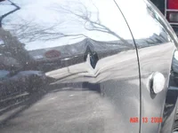 dent2.webp