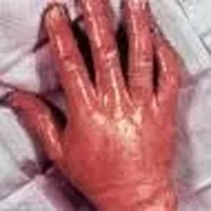 hand.JPG