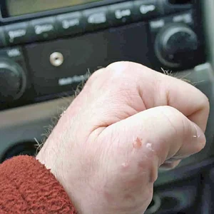 Cuts&Scrapes.jpg