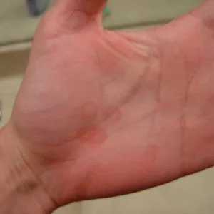 damage1.jpg