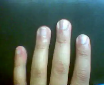 bodymod.webp
