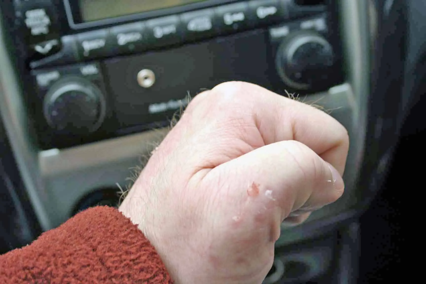 Cuts&Scrapes.jpg