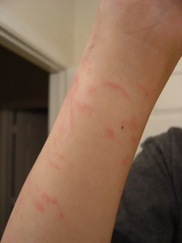 damage3.jpg