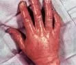 hand.JPG