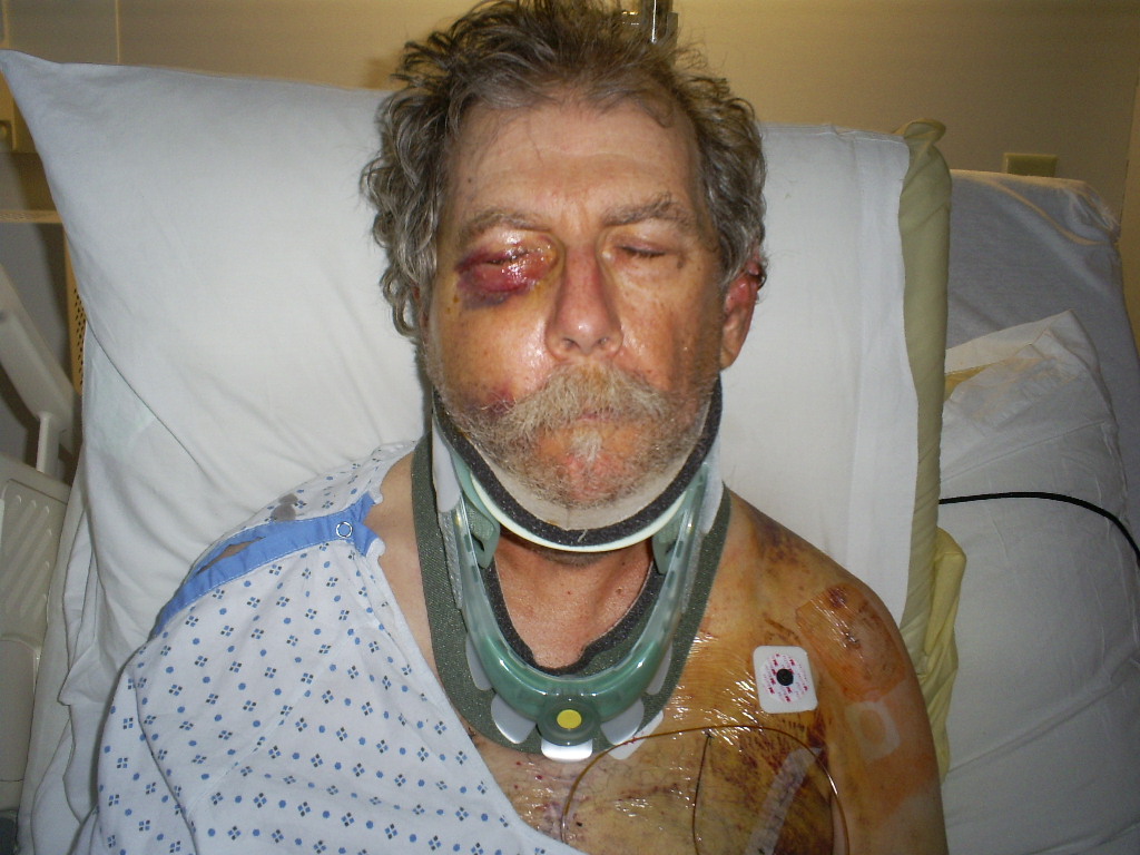 ed_hurt_facial_injuries.jpg