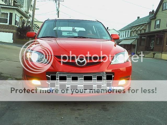 interbraces.jpg