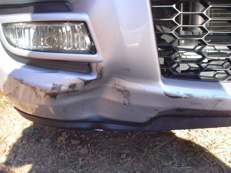dent2.jpg