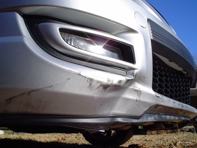 dent1.jpg